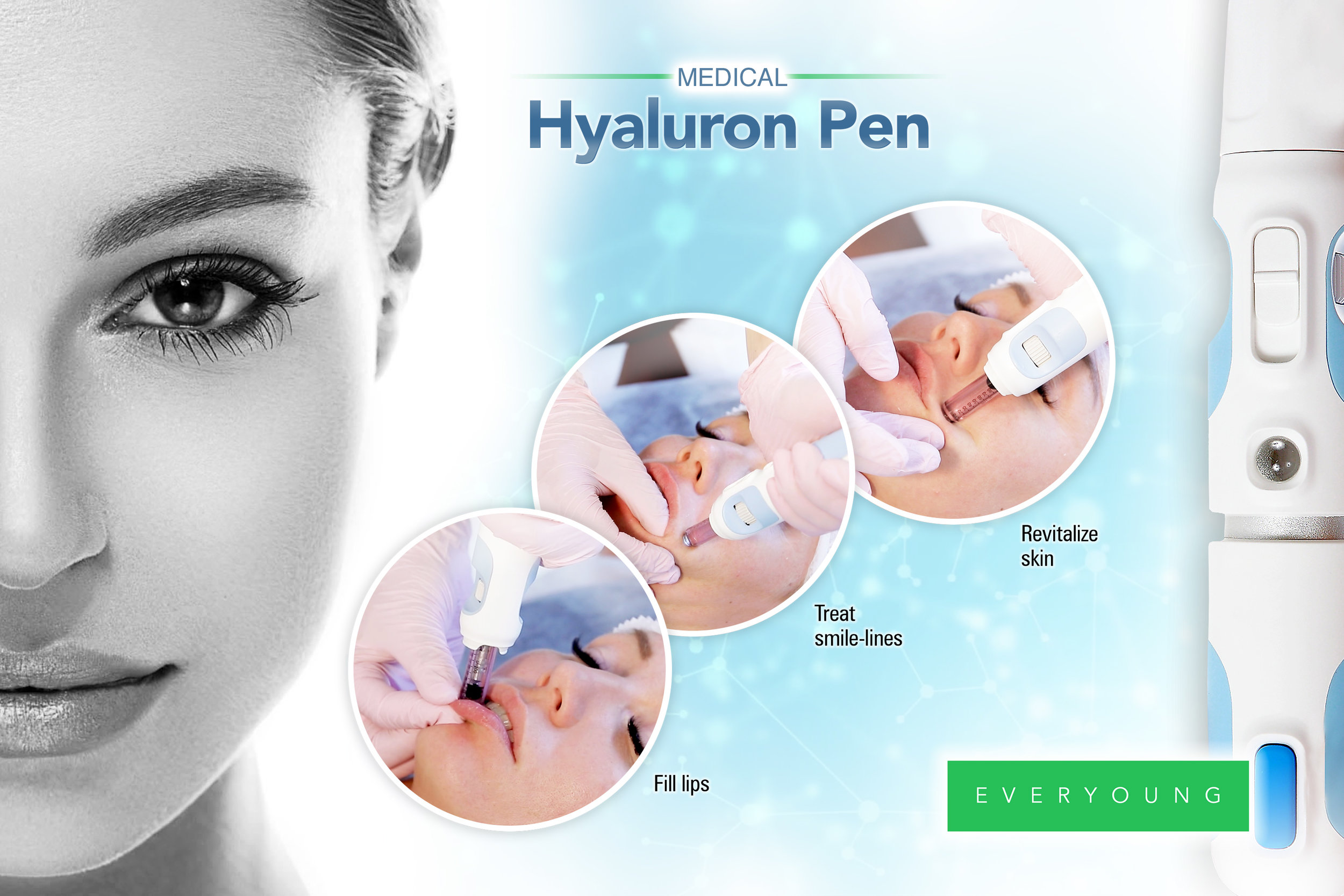 hyaluron-pen